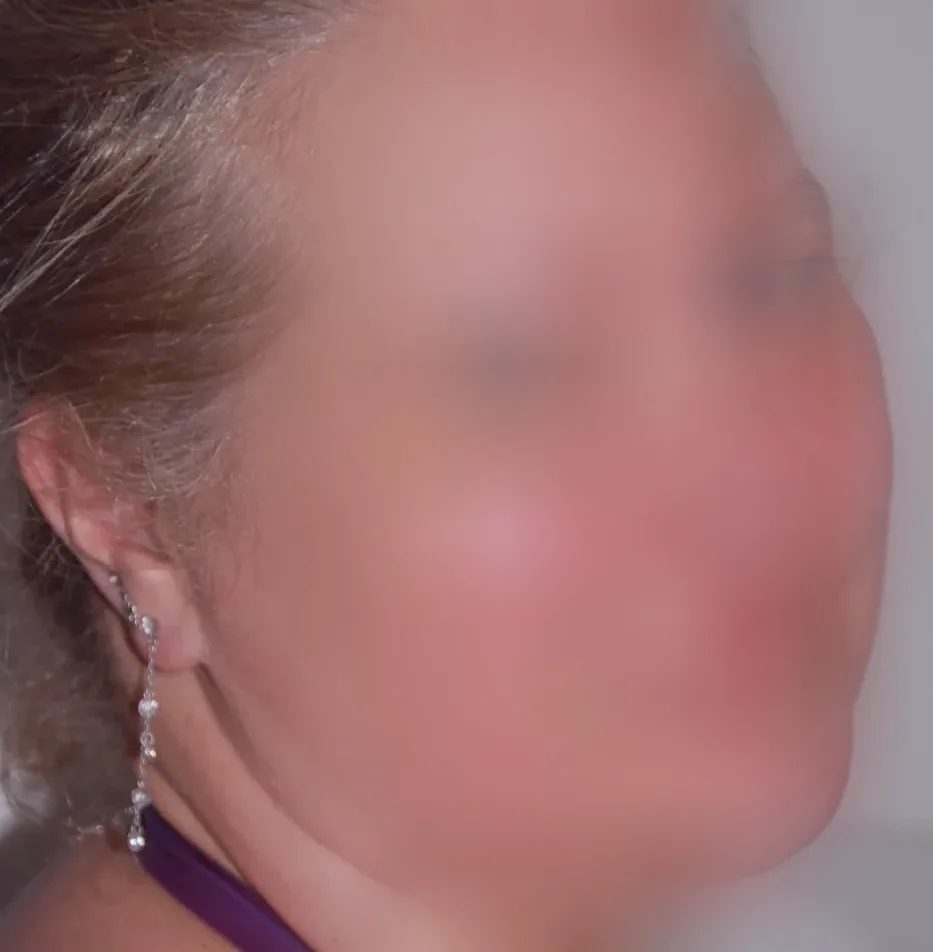 Filomena, 28 anni